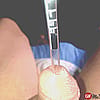 next post
